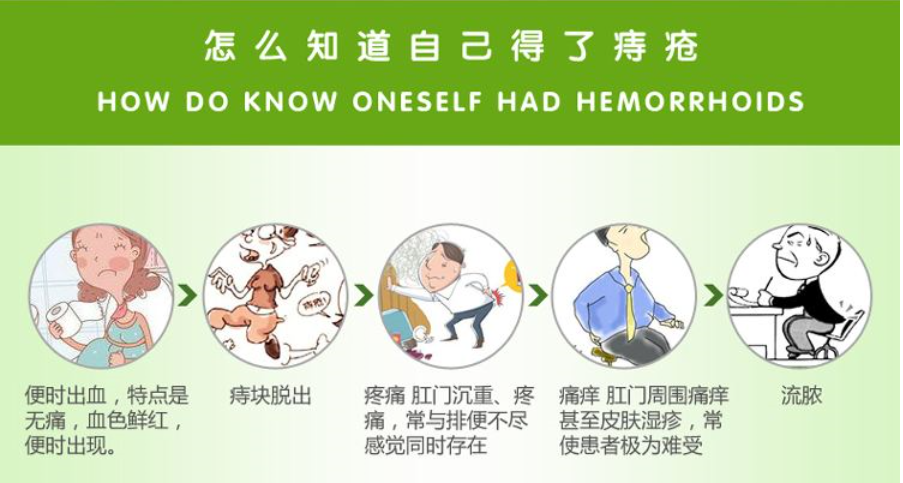大连金州宁城县痔疮有什么症状？得了痔疮好治吗？