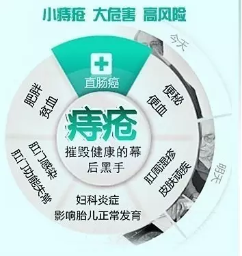 大连金州翁牛特旗一期痔疮如何防止痔疮恶化